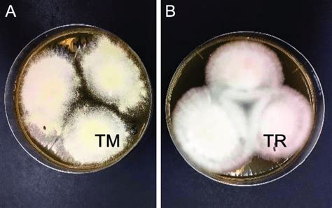 Macroscopic Observation Of Colony Morphology On Sabouraud Dextrose Agar