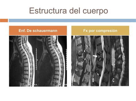 Biomec Nica El Raquis Pptx Kinesiologia Ppt