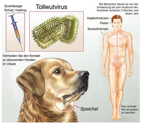 男子狂犬病发作离世，临终前注射了狂犬疫苗，为何人还是没了？