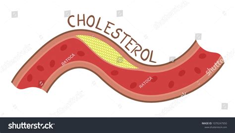 Vein Cholesterol Illustration Stock Vector Royalty Free 1079247950 Shutterstock