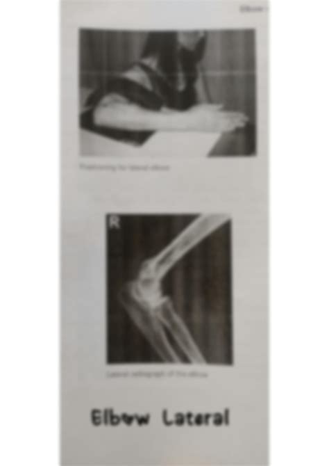 Solution Forearm And Elbow Radiography Studypool