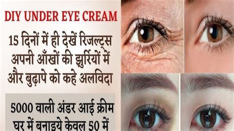 1 ही रात मे आंखों के काले घेरे हटाने के घरेलू नुस्खे Dark Circles