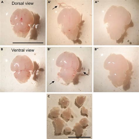 Dissection Of Mouse Brain At P0 A And B Removing The Meninges From