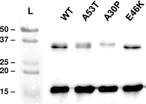 Analysis Of Synuclein Preparations Representative Western Blot Of