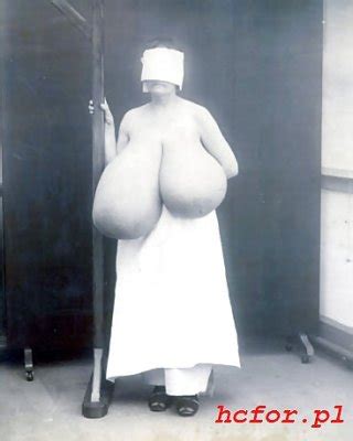 Schlaffe Titten Porno Bilder Xxx Bilder Sex Bilder Pictoa App Page Pictoa