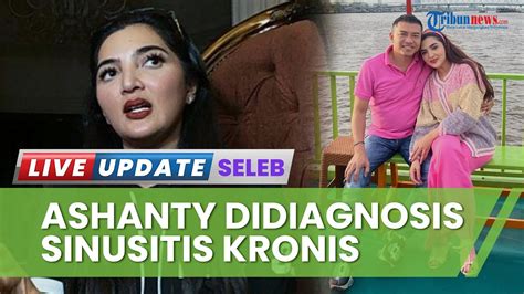 Kondisi Terkini Ashanty Setelah Divonis Dokter Mengidap Sinusitis