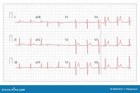 Heart Cardiogram Chart Vector Healthy Heart Electrocardiogram Pulse