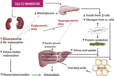 Supplemental Materials For Perioperative Diabetic Ketoacidosis