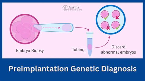 Preimplantation Genetic Diagnosis A Complete Overview