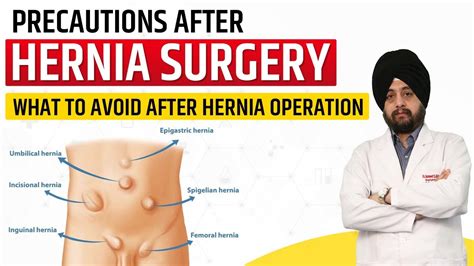 Precautions After Hernia Surgery What To Avoid After Hernia Operation