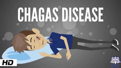 Chagas Disease Causes Signs And Symptoms Diagnosis And Treatment