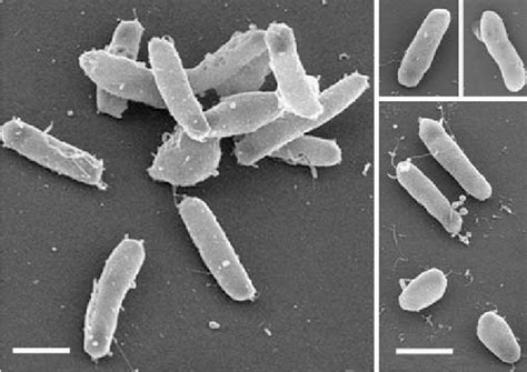 Halobacterium Salinarum Microscope