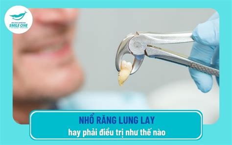 Nhổ răng lung lay có nên hay xử lý như thế nào