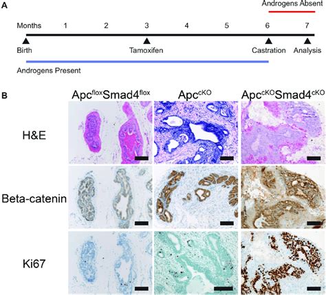 Tumors In Apc CKO Smad4 CKO Mice Are Castration Resistant A Timeline