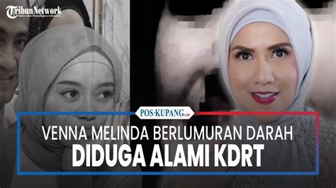 LIVE UPDATE SELEB Venna Melinda Berlumuran Darah Hingga Lesti Kejora