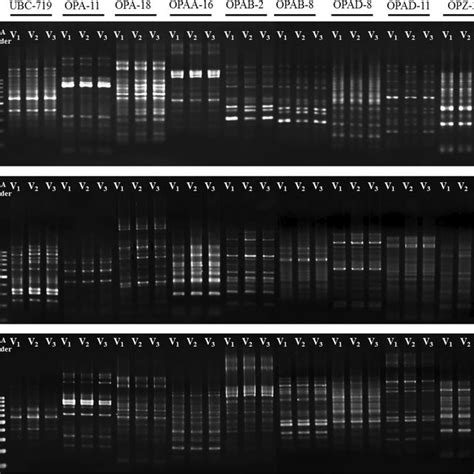 Gel Electrophoresis Of Random Amplification Of Polymorphic Dna Rapd