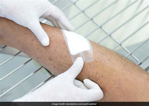 First aid for cuts and wounds – NDTV.com Photo Gallery