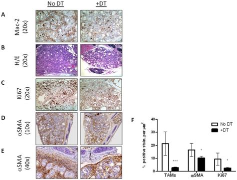 Targeting CCR2 Expressing Cells In BRAF Induced PTC Mice Results In