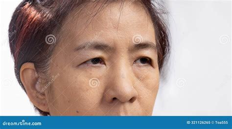 The Ptosis Or Droopy Eyelids In Asian Senior Woman Stock Image Image