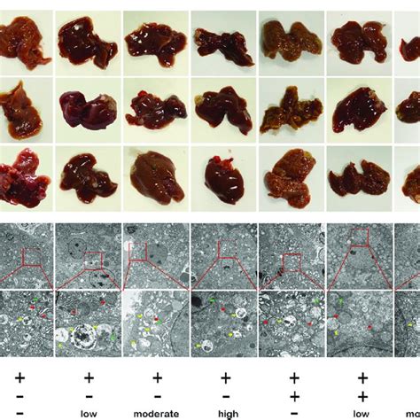 ART Reduces Tumor Burden And Impairs GBA Mediated Autophagic