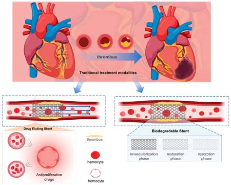 Biosensors Free Full Text Liquid Metal Based Flexible Bioelectrodes