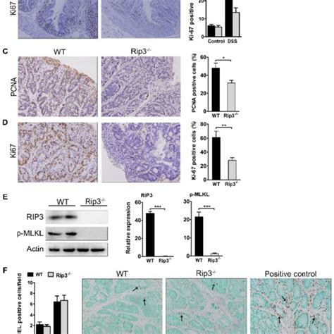 RIP3 Promotes Epithelial Cell Proliferation And Tumor Growth Without