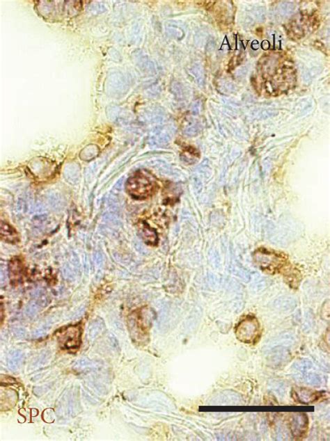 Composition Of Epithelial Cell Types In Conducting Airway Epithelium Of Download Scientific