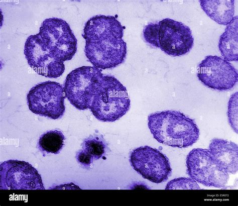 Neisseria Gram Stain