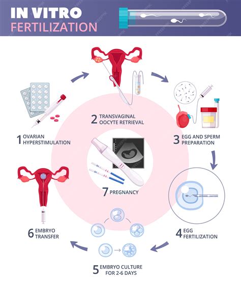 Infografía De Fecundación In Vitro Plana Y Coloreada De Fiv Con Pasos