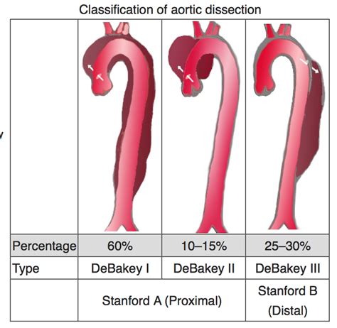 test  time acute  chronic aortic dissections