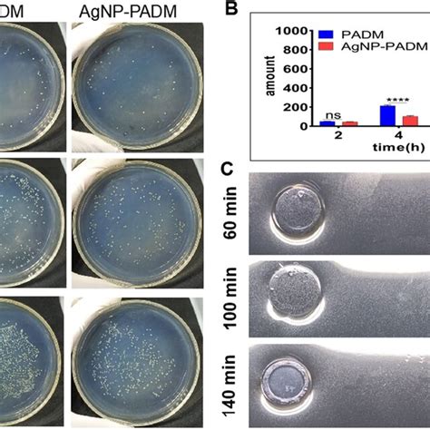 A Infected Wound Healing In Padm And Agnp Padm Hydrogel Groups On Days