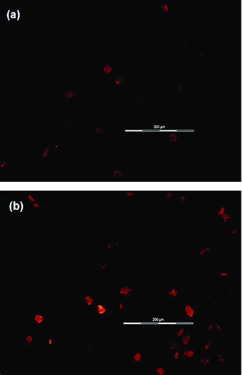 Fluorescence Microscopic Imagesrecorded From Cho A And Mcf B Cell