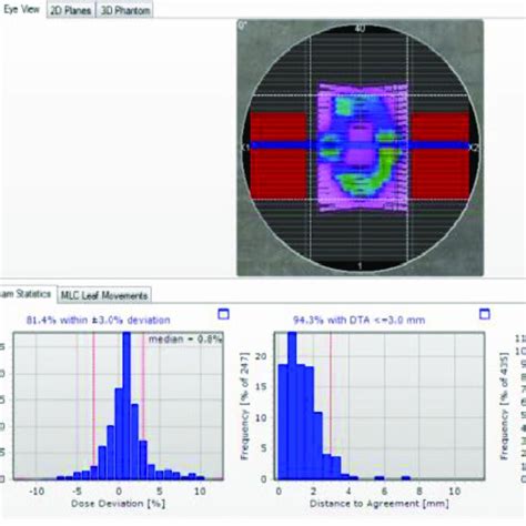 Dose Distribution Dose Deviation Distance To Agreement And Gamma