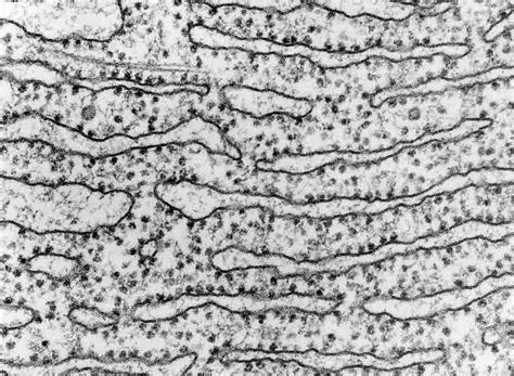 Ribosome Protein Factory Definition Function Structure And Biology