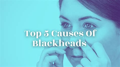 Top 5 Causes Of Blackheads