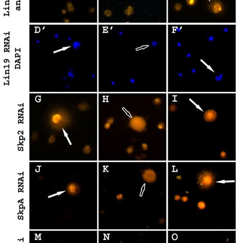 The Scf Complex That Functions In Hematopoiesis Consists Of Lin