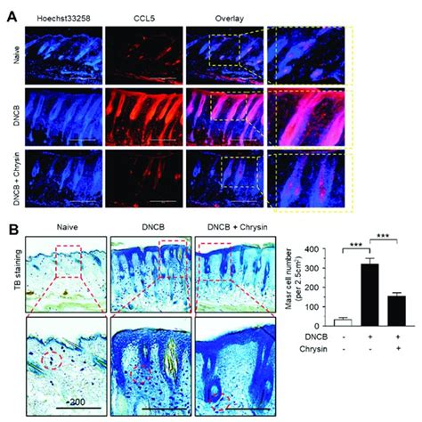 Effect Of Chrysin On The Suppression Of Ccl Expression And The