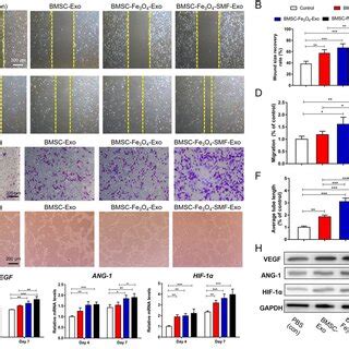 Magnetic Stimulation Enhances The Angiogenic Effect Of Exosomes In