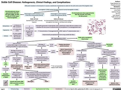 Sickle Cell Disease Pathogenesis Clinical Findings And Complications