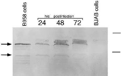 Detection Of Lmp Proteins In Infected Bjab Cells Bjab Cells Were