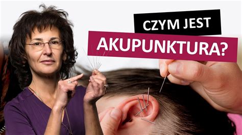 Czym Jest Akupunktura Czy Akupunktura Dzia A Youtube