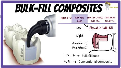 Bulk Fill Composites How Is Depth Of Cure Increased What Is Sonic