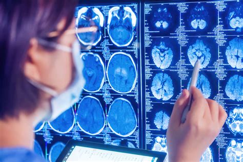 Neurorradiologia Entenda Como Funciona Telelaudo