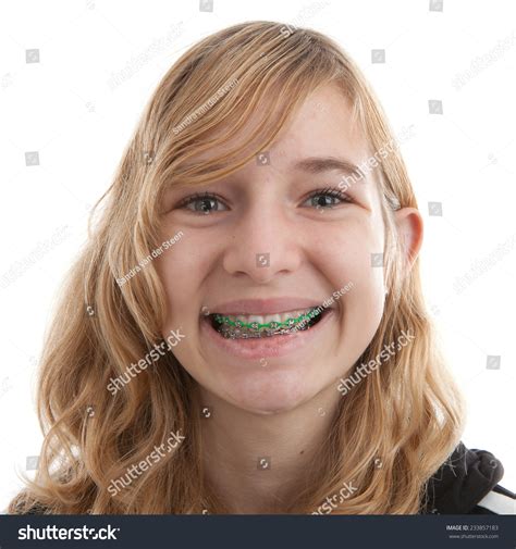 Pictures Of Girls With Braces Telegraph