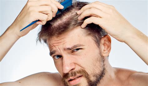 Trapianto Di Capelli Con Cellule Staminali Come Funziona