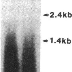 Left Size Distribution Of ARNA Compared With Parent CDNA Equal Cpm