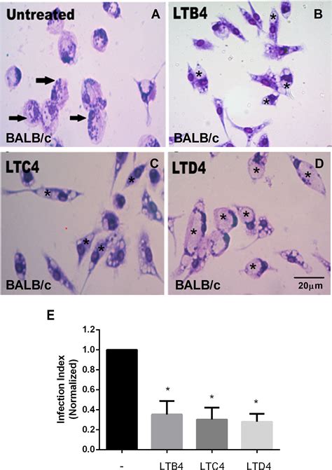 Frontiers Cysteinyl Leukotrienes Promote Cutaneous Leishmaniasis Control