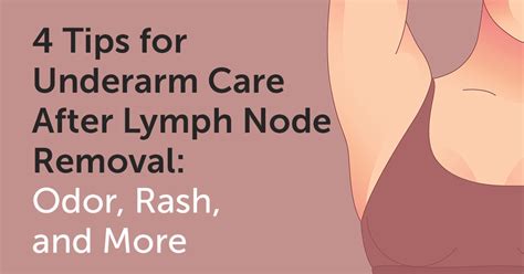 Swollen Lymph Nodes Armpit