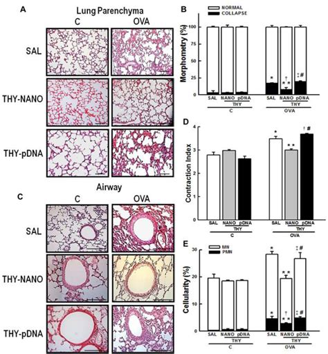 Figure 1 From DNA Nanoparticle Mediated Thymulin Gene Therapy Prevents