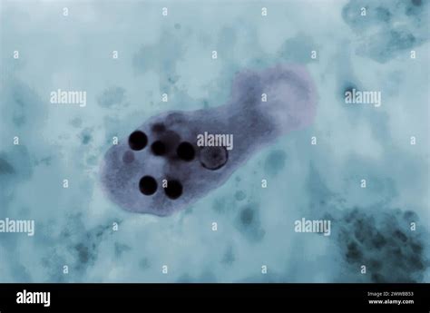 This Photomicrograph Of A Trichrome Stained Specimen Revealed The Presence Of An Entamoeba